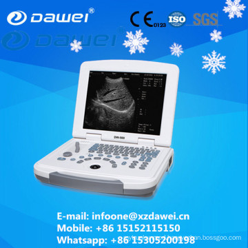 DW-500 diagnostic ultrasound equipment laptop ultrasound scanner